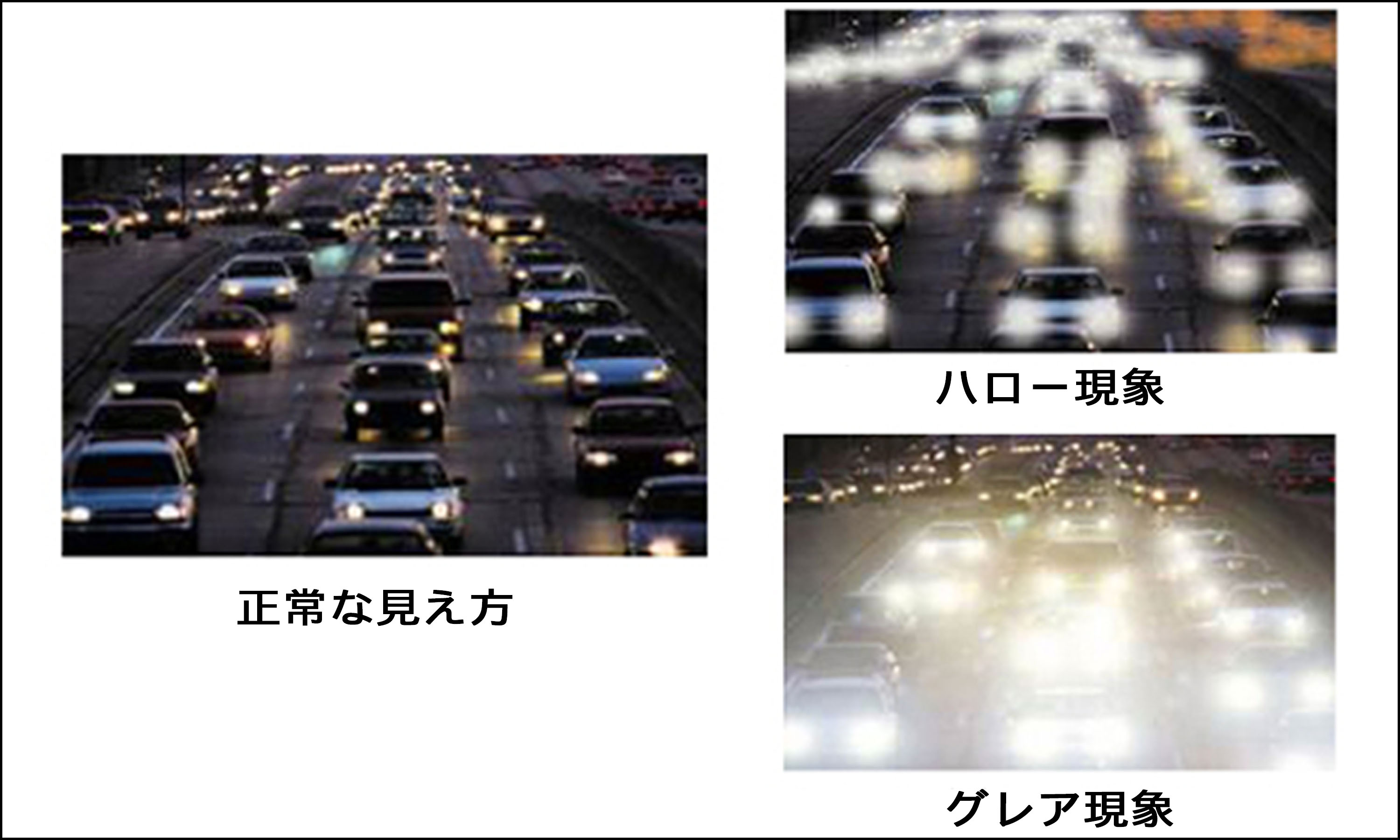 レーシックは安全？手術1000件の眼科医が教える、自分にとって最適な手術の受け方の画像9