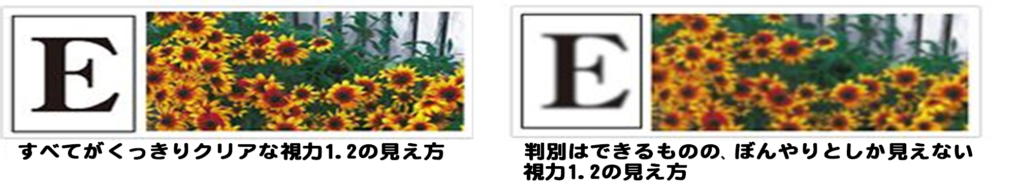 レーシックは安全？手術1000件の眼科医が教える、自分にとって最適な手術の受け方の画像8