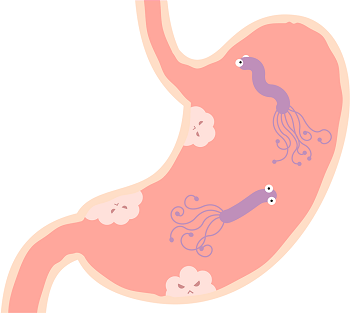 胃がんの原因「ピロリ菌」とは？専門医が感染経路や除菌方法を解説の画像1