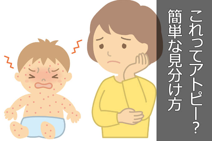 医師が伝授 アトピーかな 乳児湿疹 小児湿疹 とあせもの簡単な見分け方 １万年堂ライフ